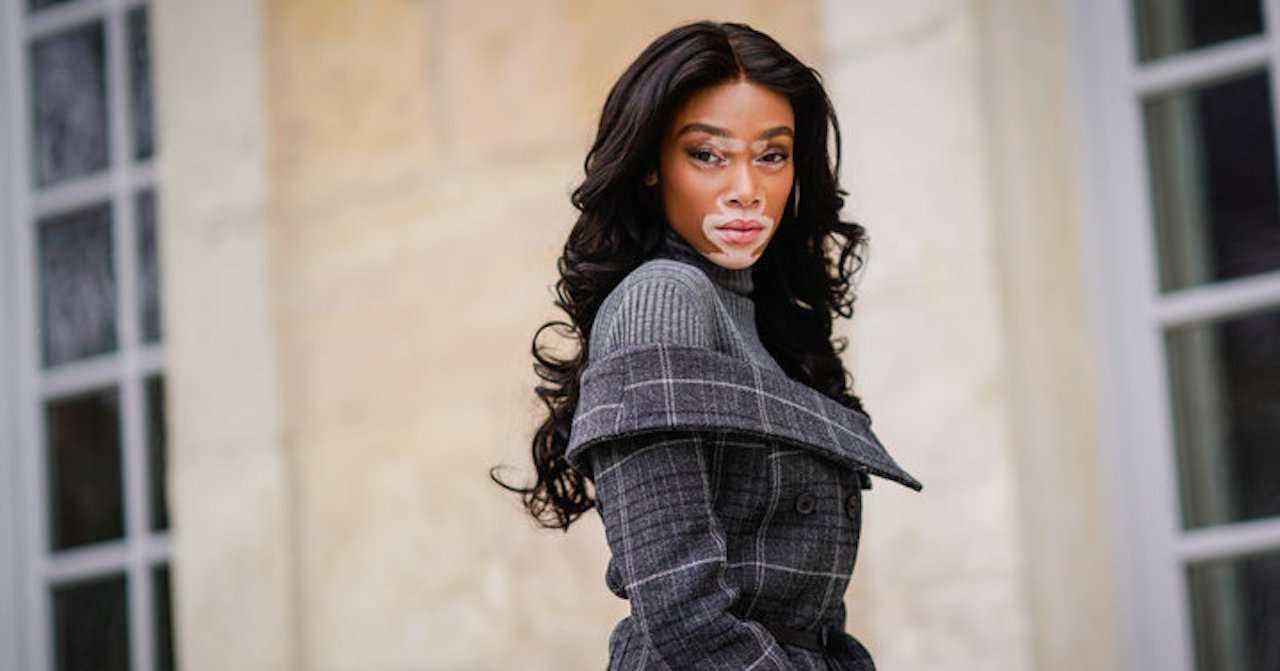 Winnie Harlow, black models, vitiligo, black excellence, skin conditions